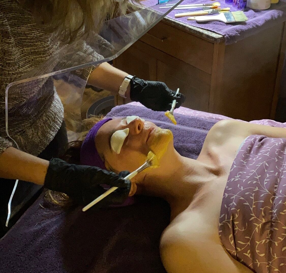 How Does a Facial Help With Acne? Fox Ridge, WI Experts Explain the Benefits