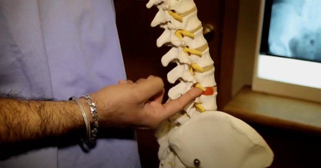 This Livermore, CA Chiropractor Offers Pinched Nerve & Back Pain Relief Therapy