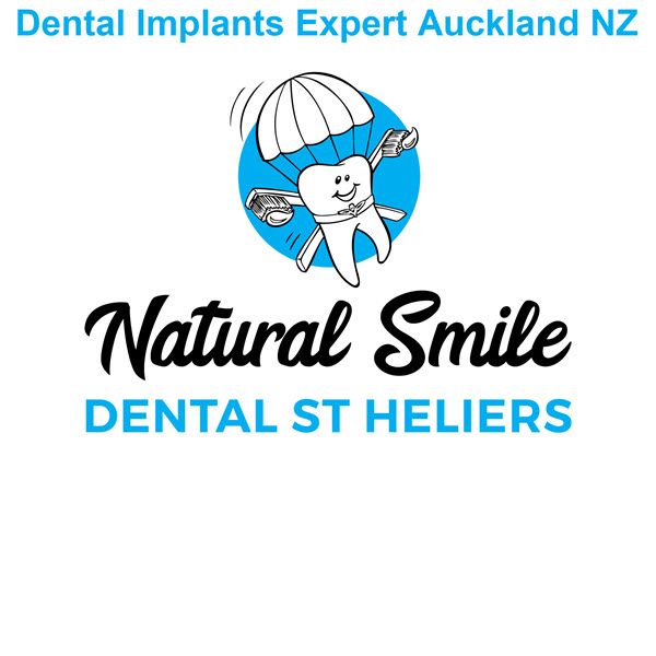 Get The Best Titanium & Porcelain 3D Dental Implants In St Heliers, Auckland