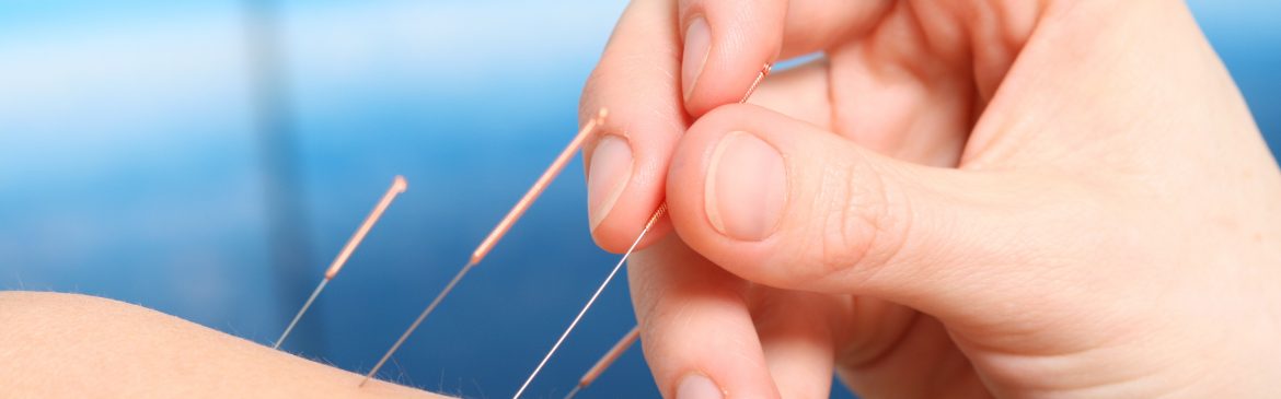 Wellness Clinic In Westbridge, WI Offers Safe, Effective Dry Needling For Pain