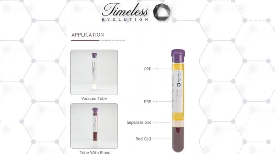 Why Autologous Conditioned PRP has Gained so Much Popularity