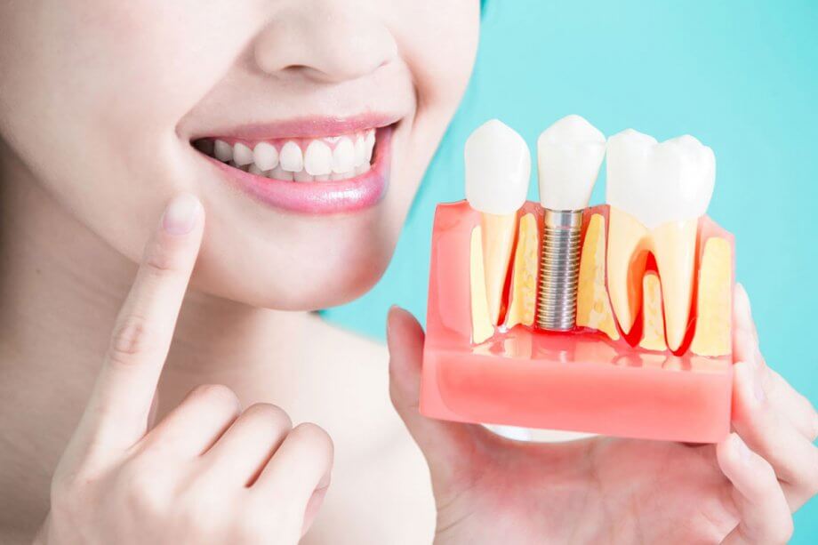 Get Affordable Dental Crowns & Implants At Top Westchase, Houston, TX Clinic