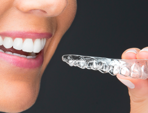 Get Custom Clear Teeth Aligners In Kent, WA From This Award-Winning Orthodontist