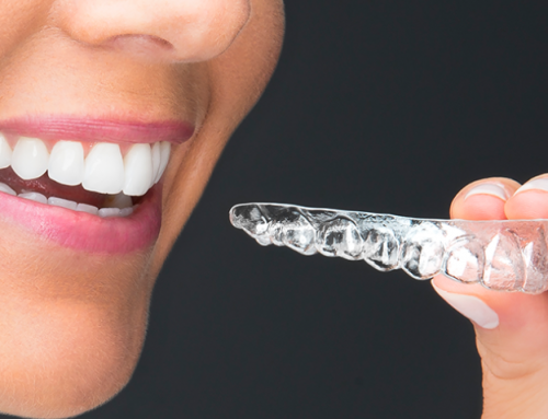 Visit This Orthodontic Practice Near Auburn, WA For Proven Teeth Straightening