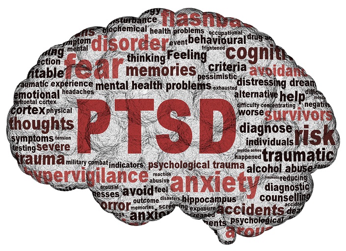 Alternative PTSD Treatment In Bellevue: SGB Procedure Reduces Anxiety Symptoms