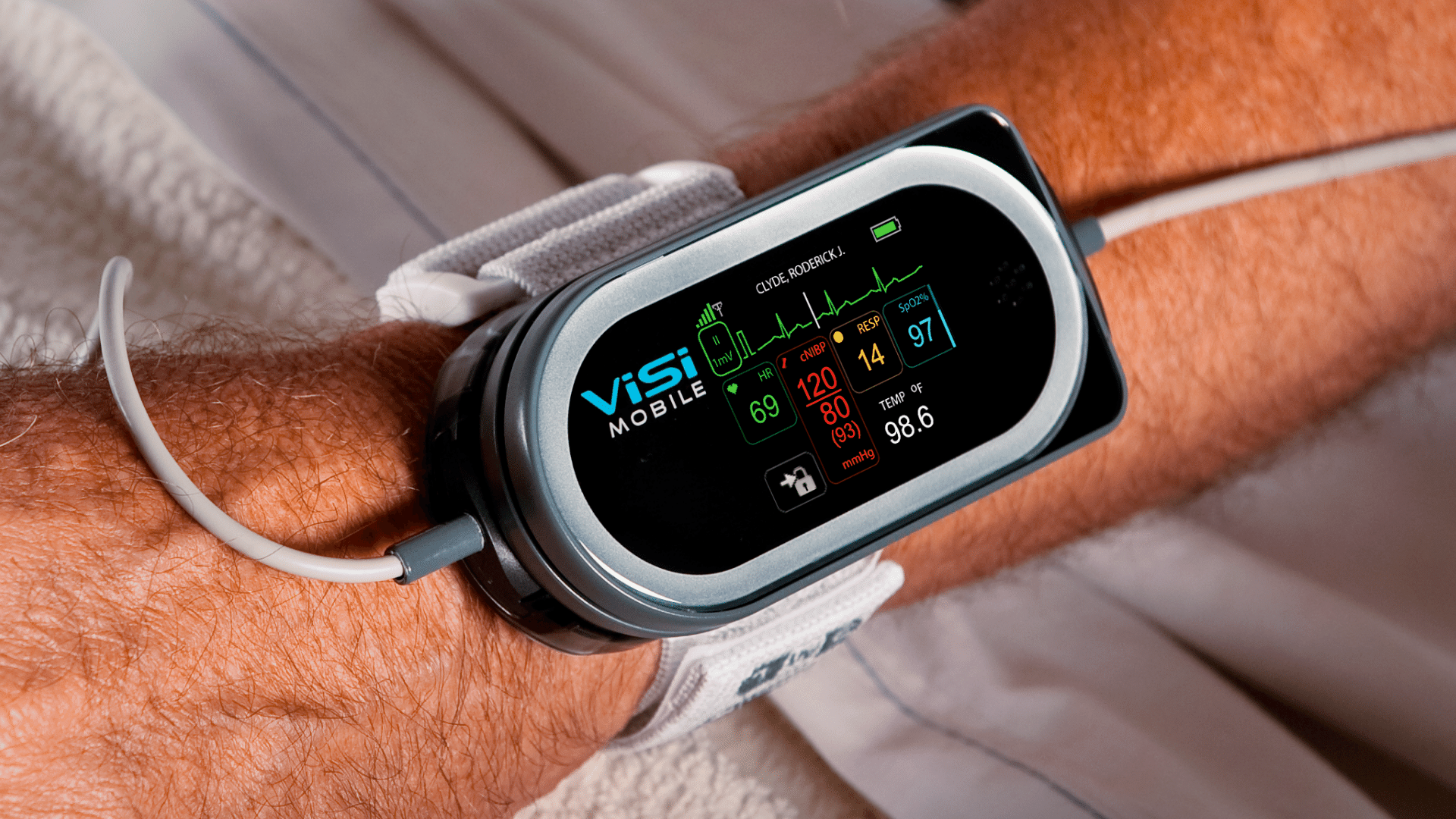 Continuous Non-Invasive Blood Pressure Device Reduces Nurse Burnout