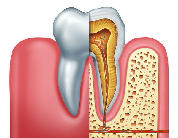 Best Root Canal Dentist In Carmel, IN - Repair Untreated Cavities/Cracked Teeth