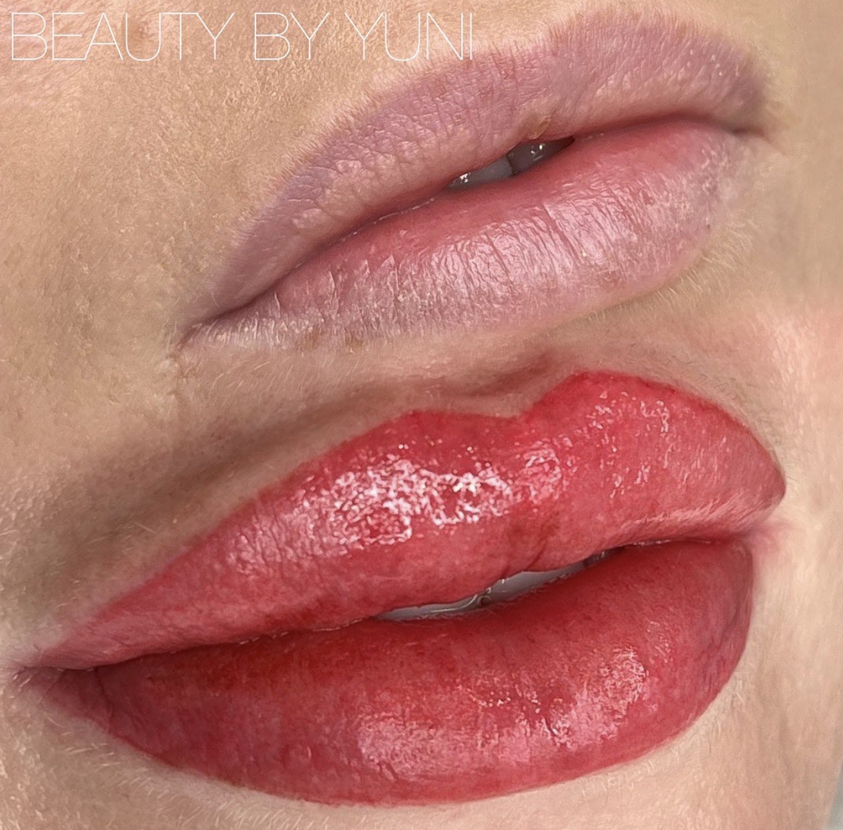 Get A Fuller, More Defined Pout With Top Gold Coast, QLD Lip Blushing Procedure