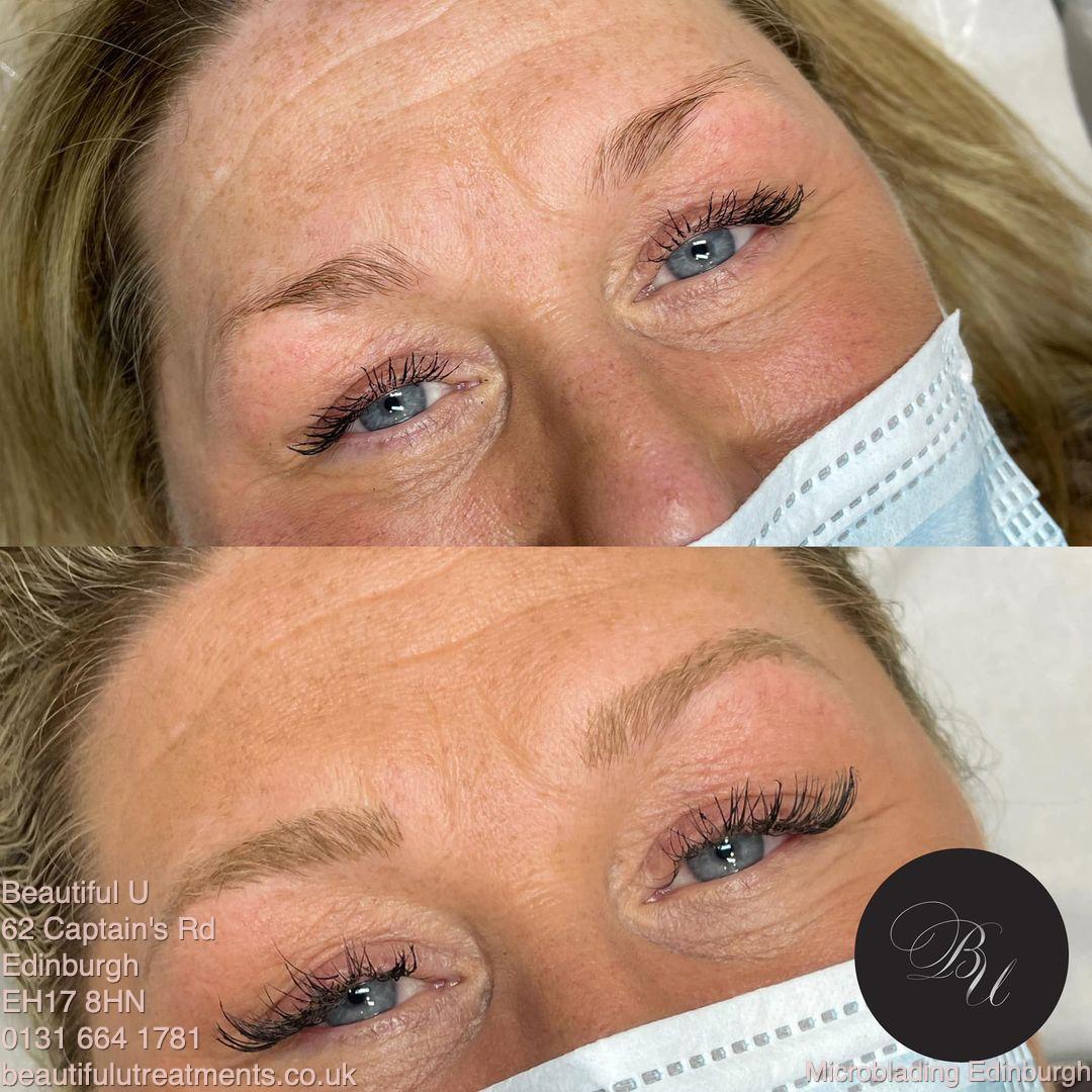Edinburgh's Beautiful U Answers What Is Microblading For Eyebrows In New Guide