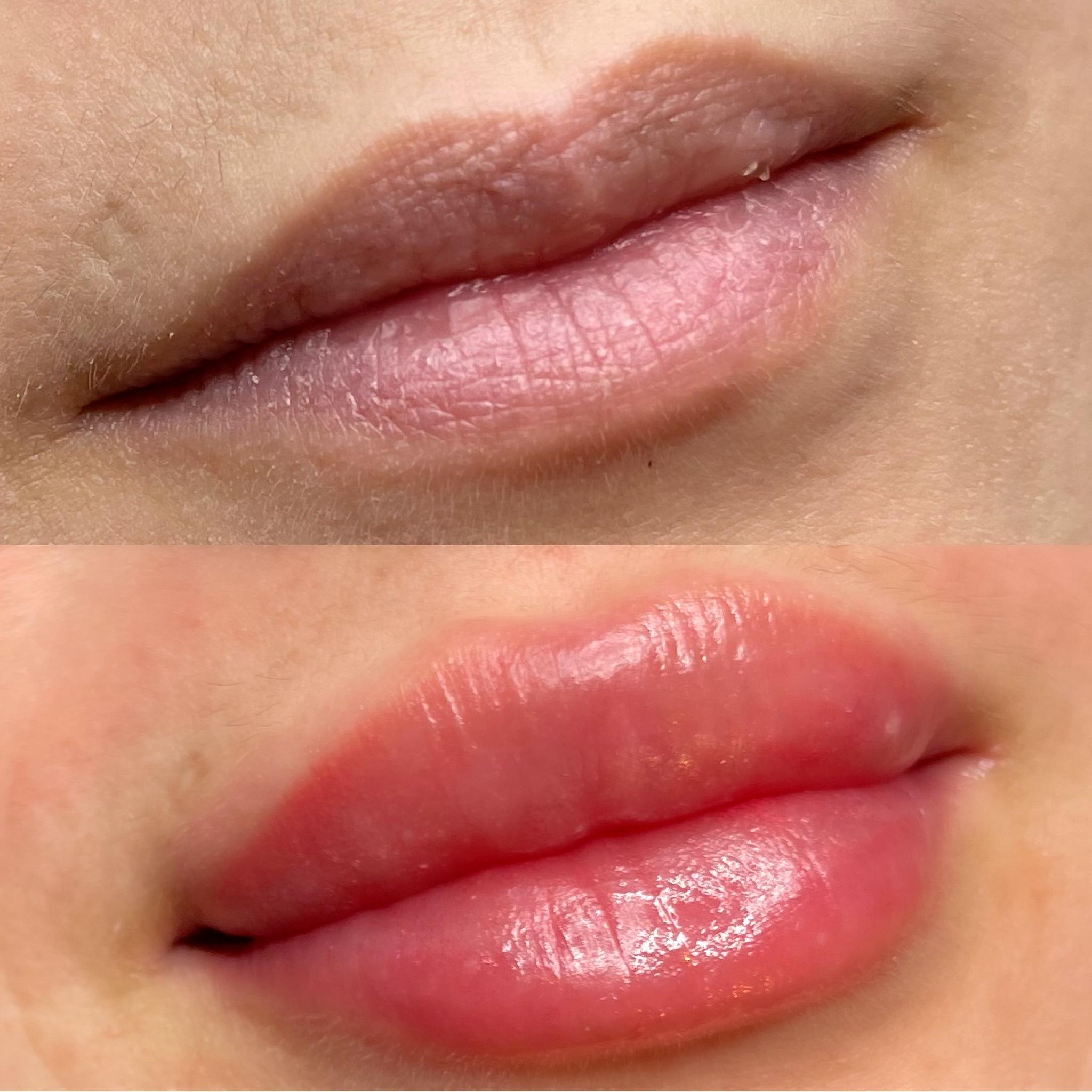 Get Younger-Looking Lips & Change Your Life With Fort Lee, NJ PMU Lip Blushing