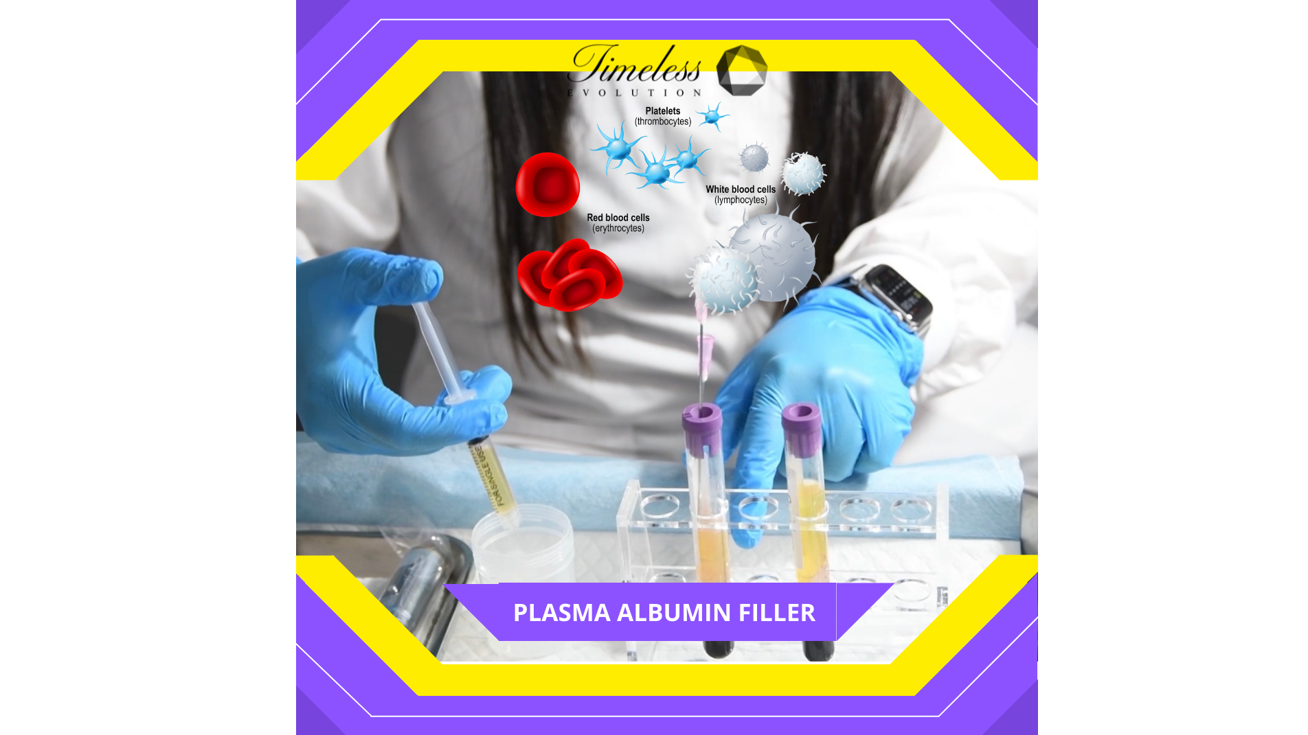 Best Dermal Filler Technology For Beauty Clinics Using Human Plasma Albumin