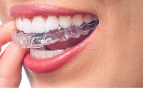 Best Invisalign Dentist In Barbados: Get Removable Clear Braces To Fix Overbite