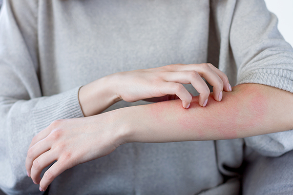 The Top Eczema & Psoriasis Products For Sensitive Skin - FAQ Answered By Experts