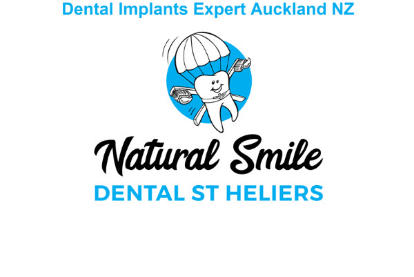 Start Smiling Again With The Best Dental Implants In Glendowie, Auckland