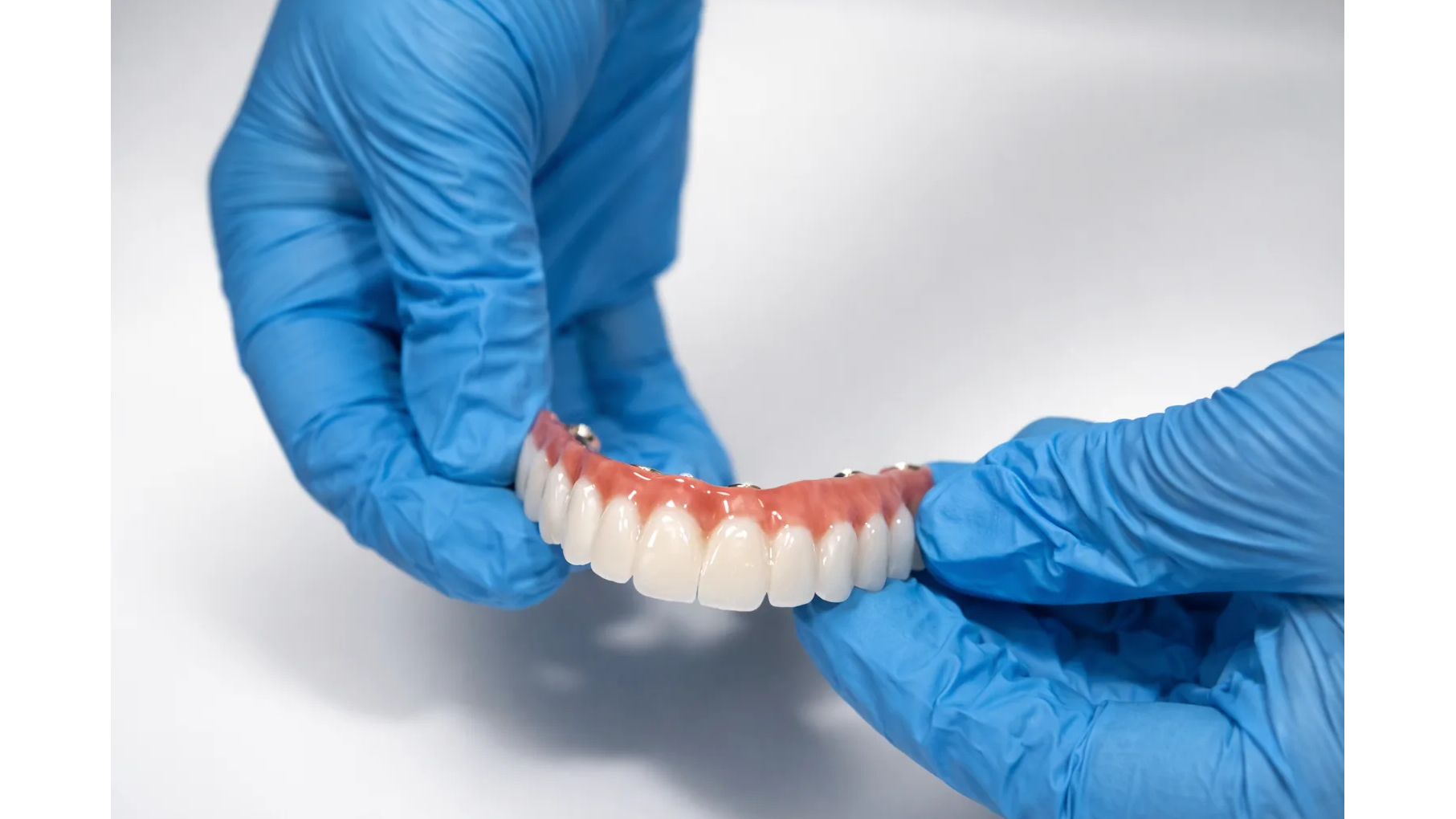 Structural Cracks vs. Manufacturing Defects: Roseville Implant Specialist