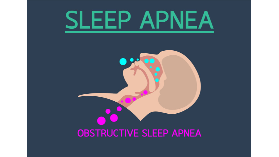 Get Obstructive Sleep Apnea Treatment To Reduce Chronic Pain At McKinney Dentist
