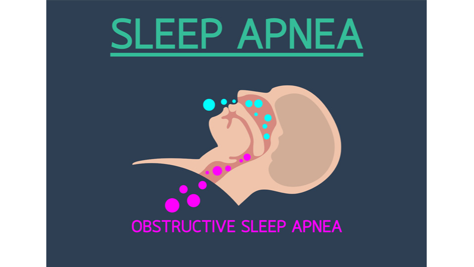 Frisco Sleep Clinic: CBCT of Airway Used for Snoring & Apnea Diagnosis