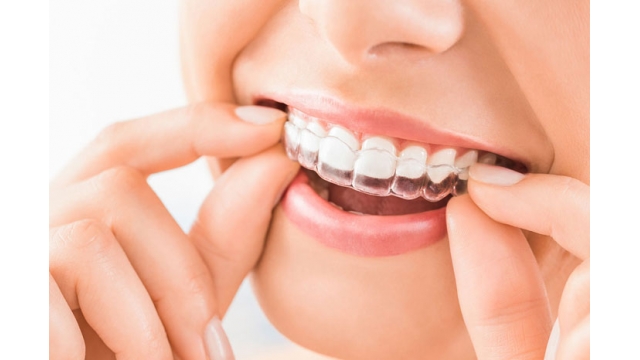 Tratamiento de ortodoncia para actualizar los dientes torcidos