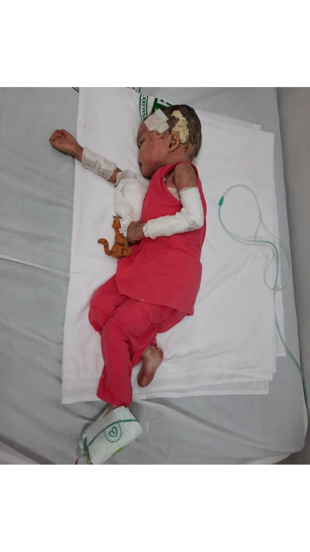 EB Blistering Skin Disease Awareness & Support Campaign For Children Expands