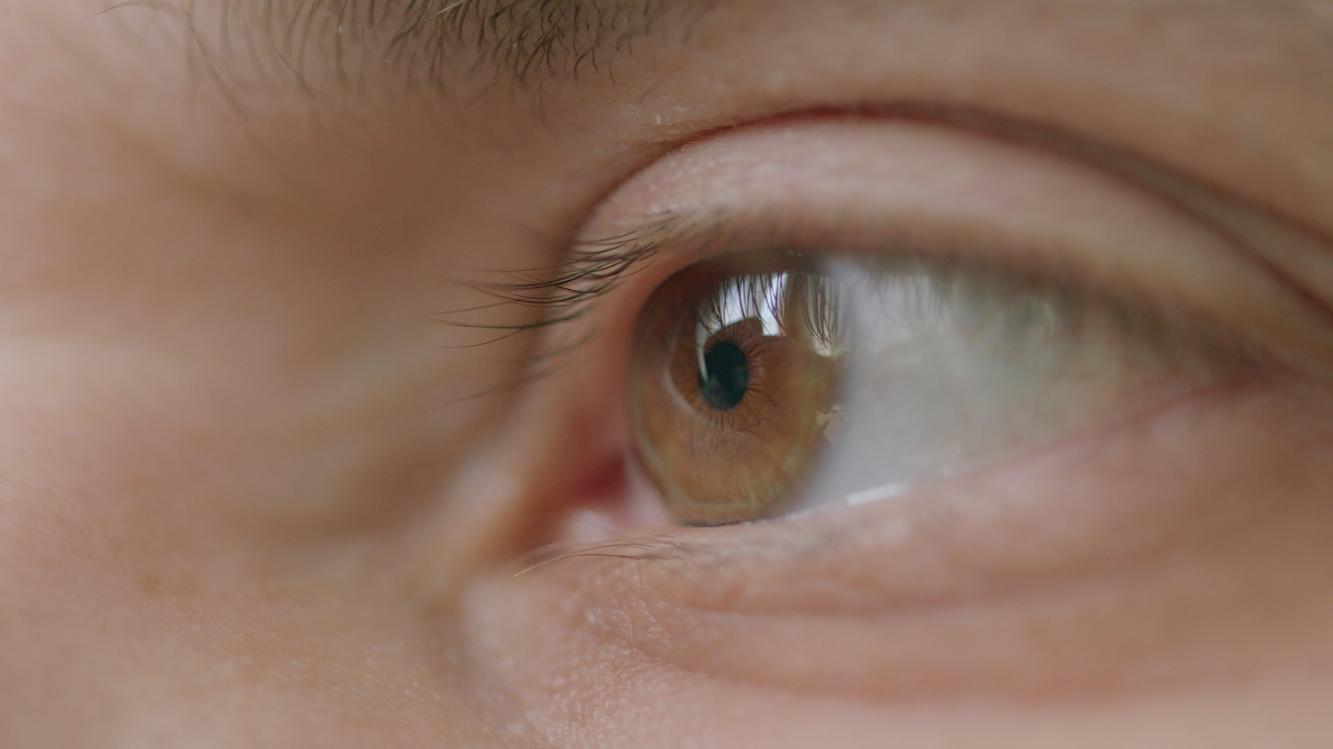 What Causes Dry Eyes: Symptoms & How to Manage It Effectively Beyond Drops