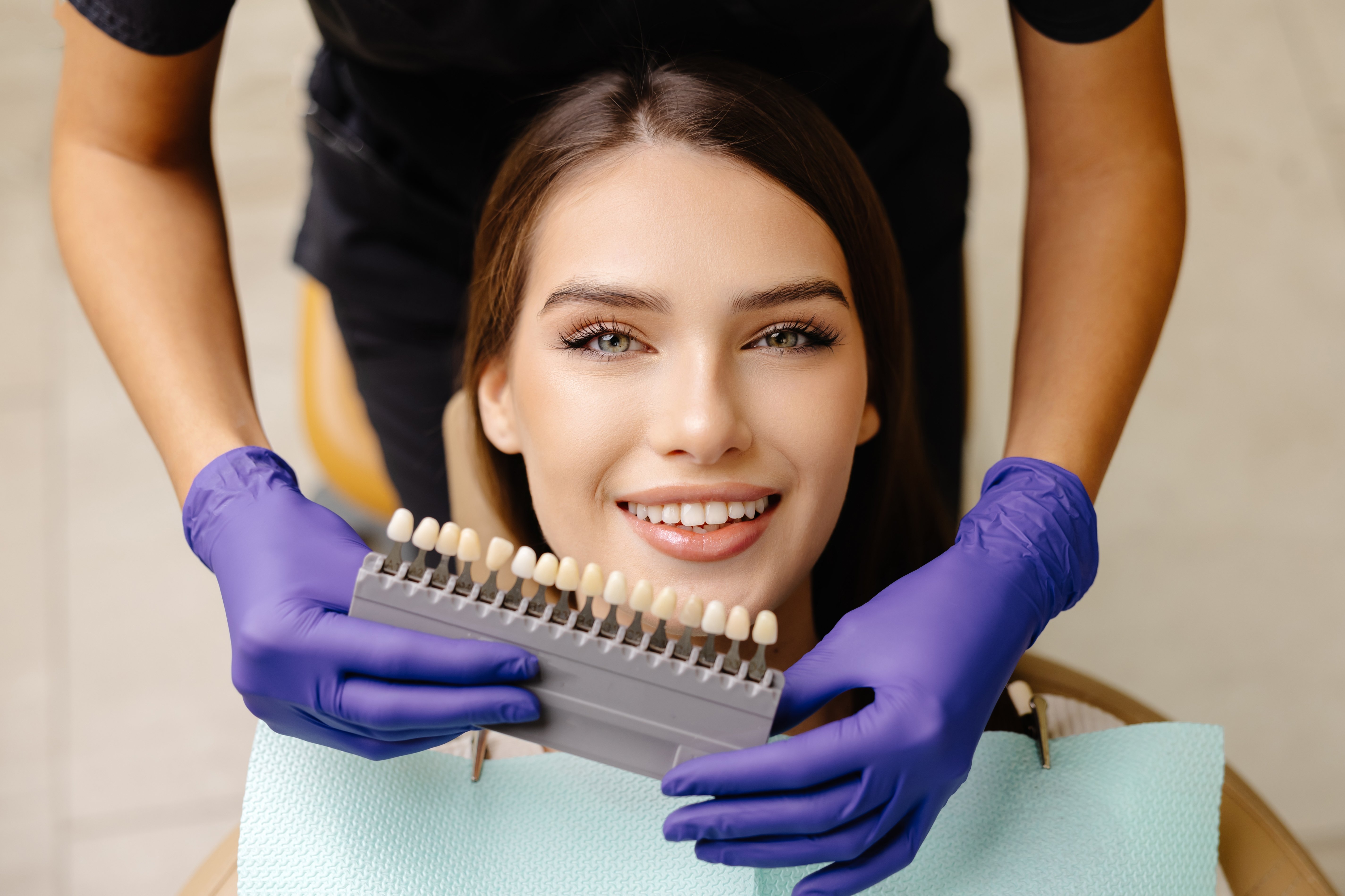 Veneers on Front Teeth: Nottingham Dentist Explains Process, Pros & Cons