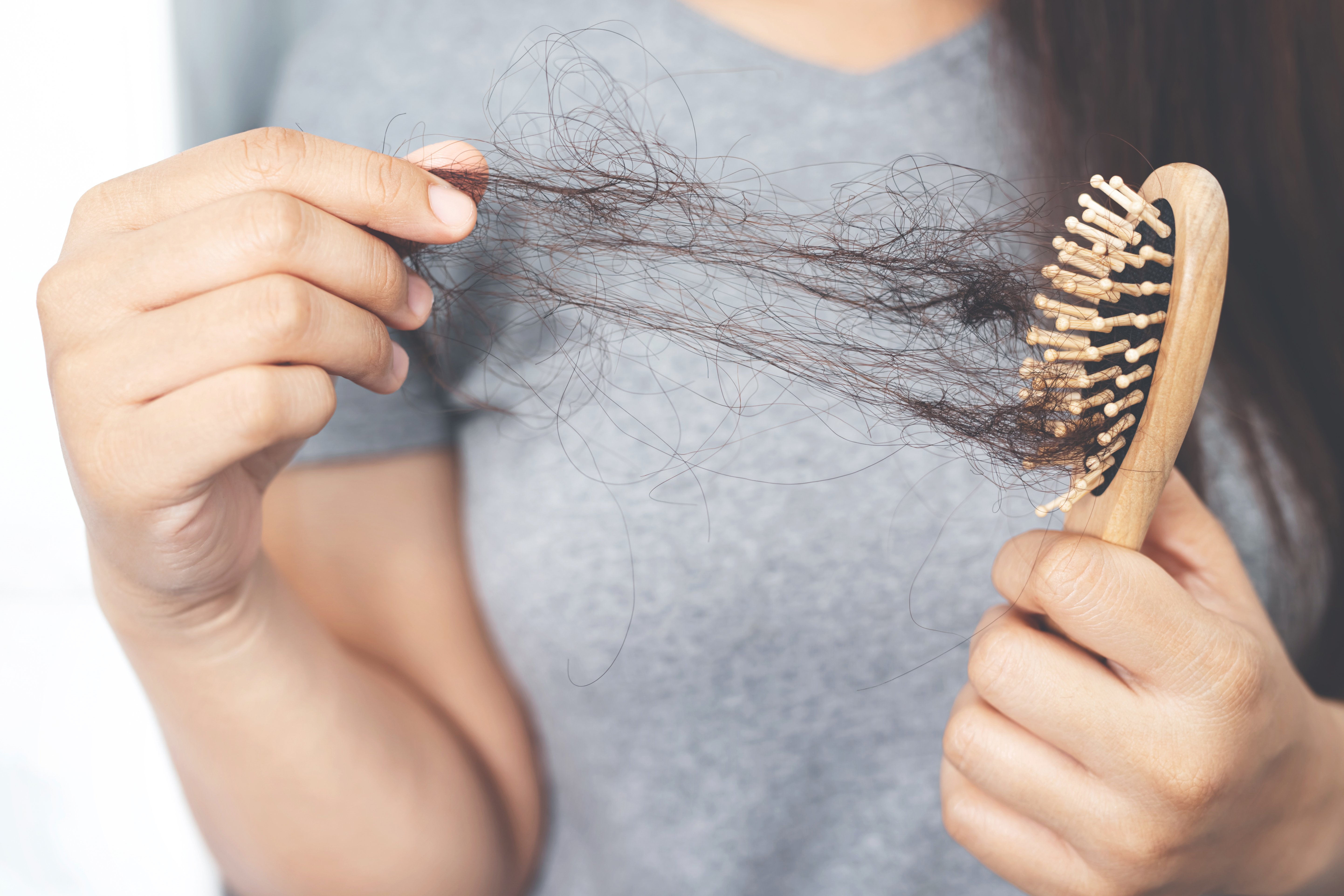 Hair Loss After Mononucleosis: Causes, Solutions & Recovery Timeline