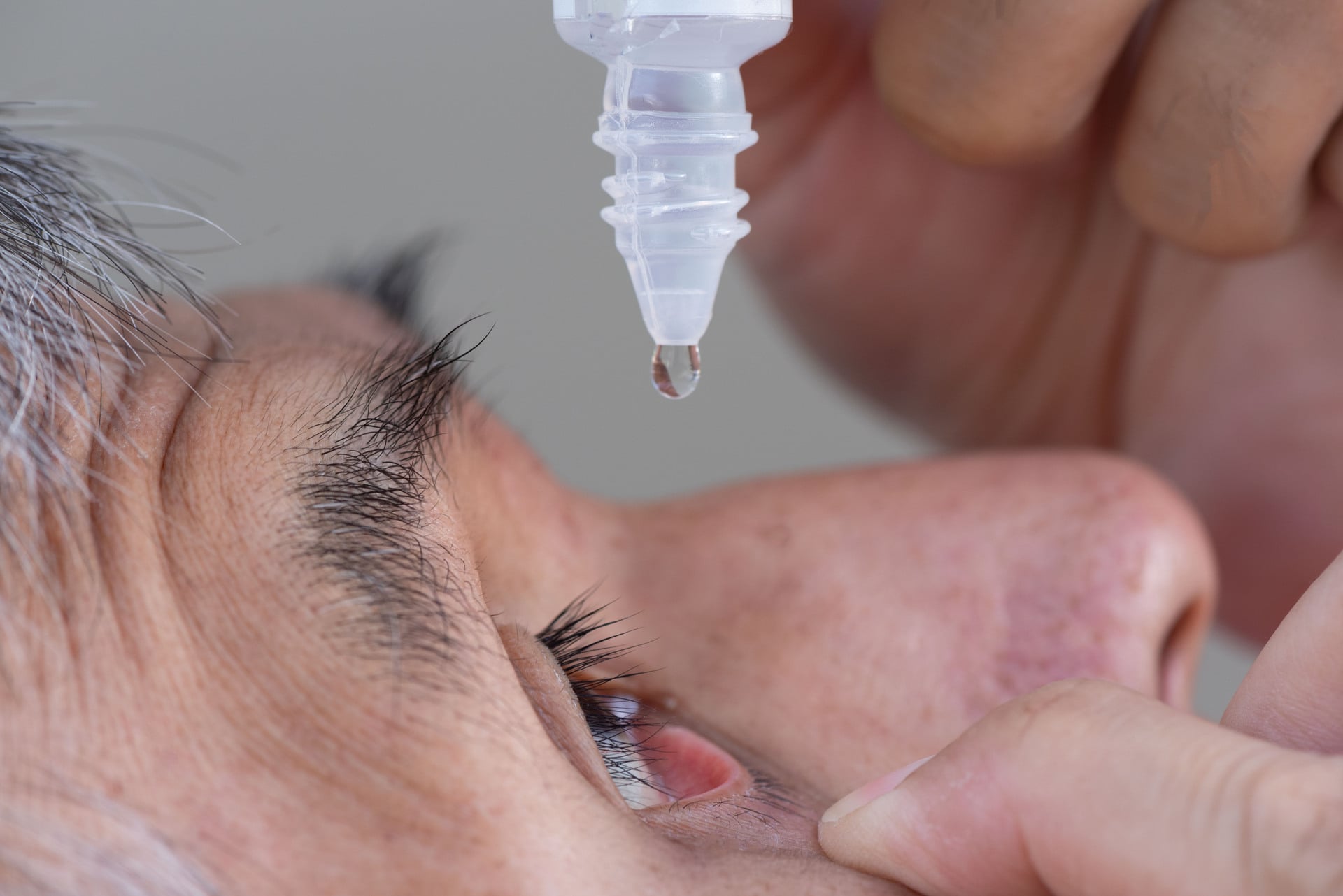 What Is Dry Eye Syndrome? Causes, Symptoms, & Why It’s Often Overlooked