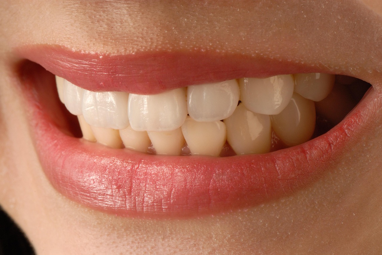 How Do I Know if I'm a Candidate for Veneers? Atlanta Dentist Shares 5 Signs