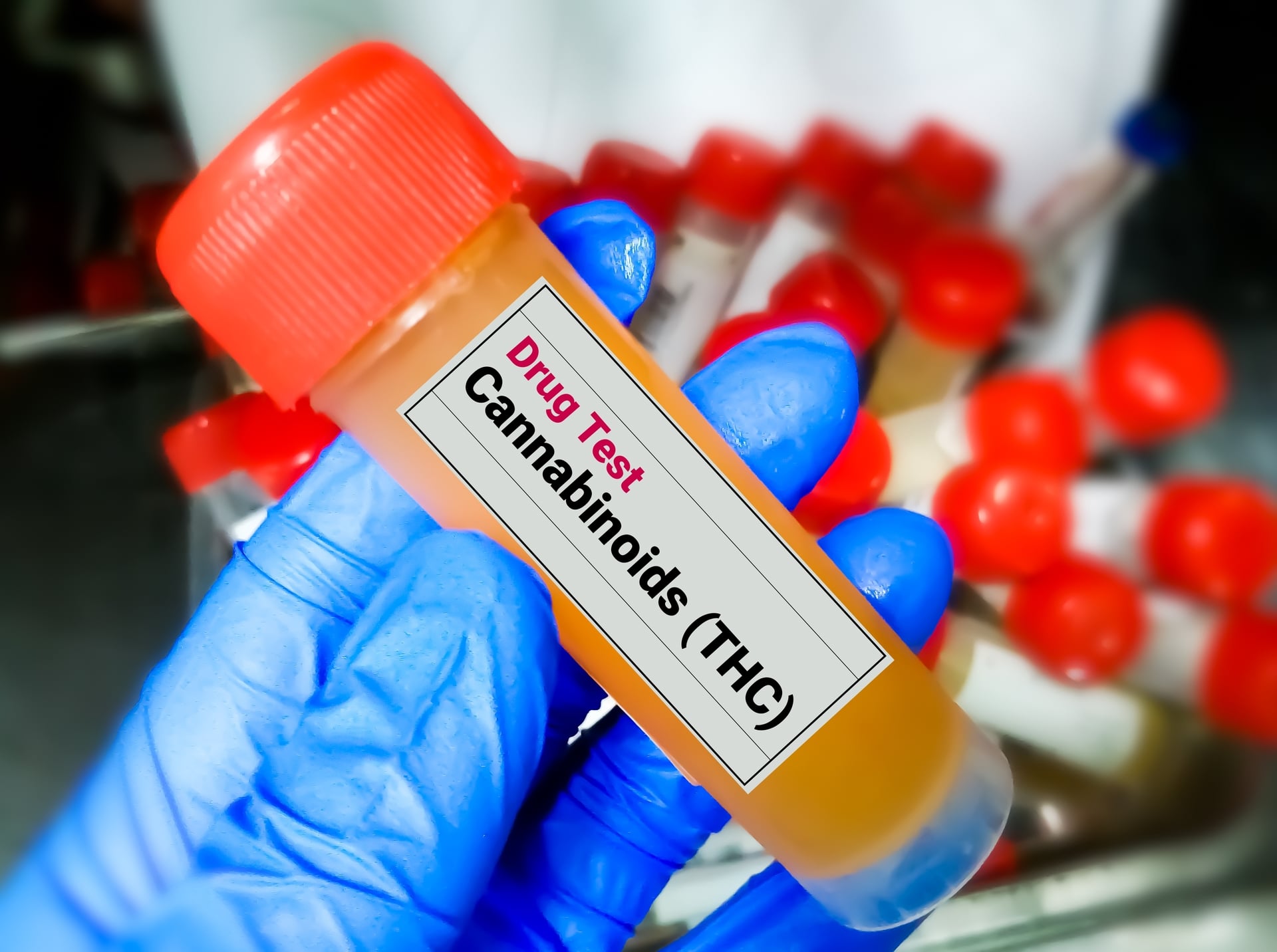 Workplace Drug Testing After Legalization: What Employers Need To Know In 2026