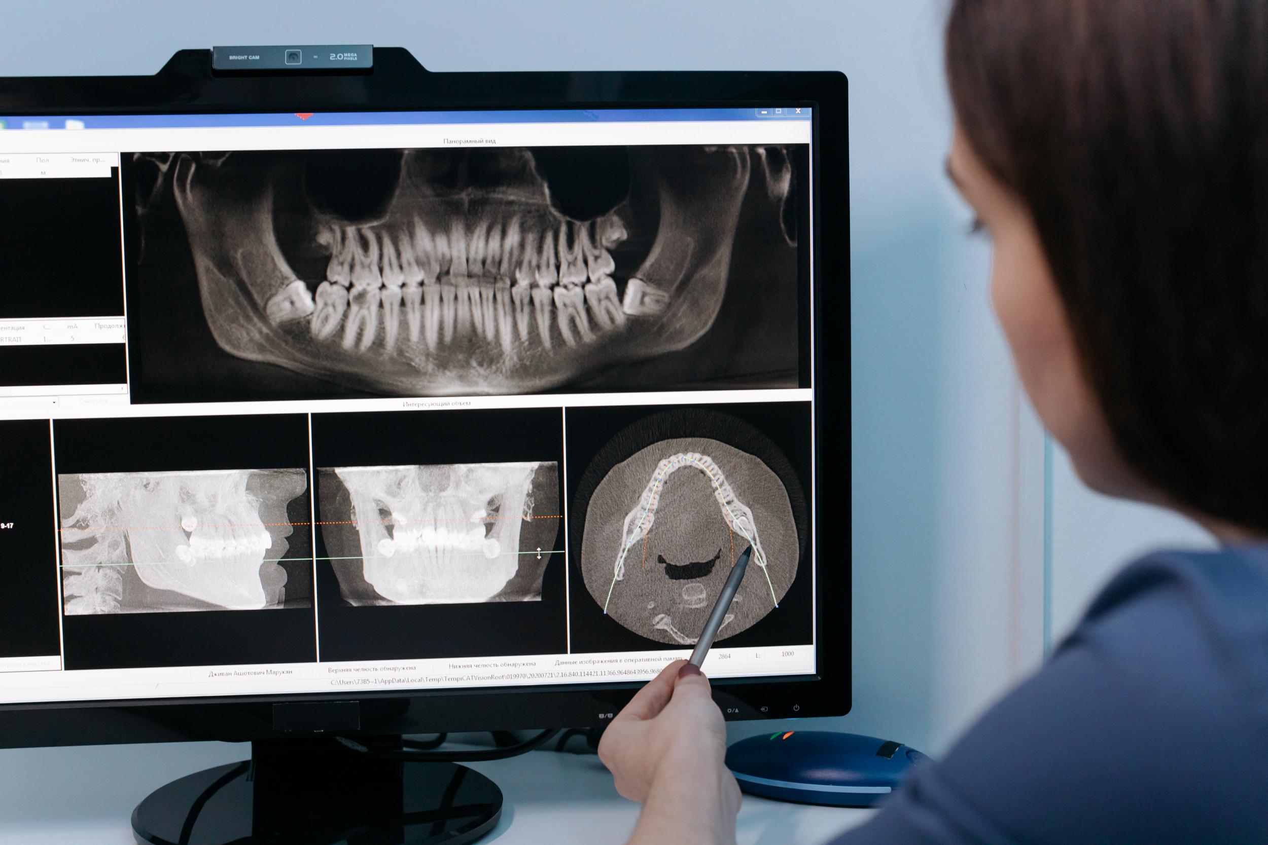Top Carmel, IN Family Dentist Offers High-Tech Digital X-Ray Exams | Call Now