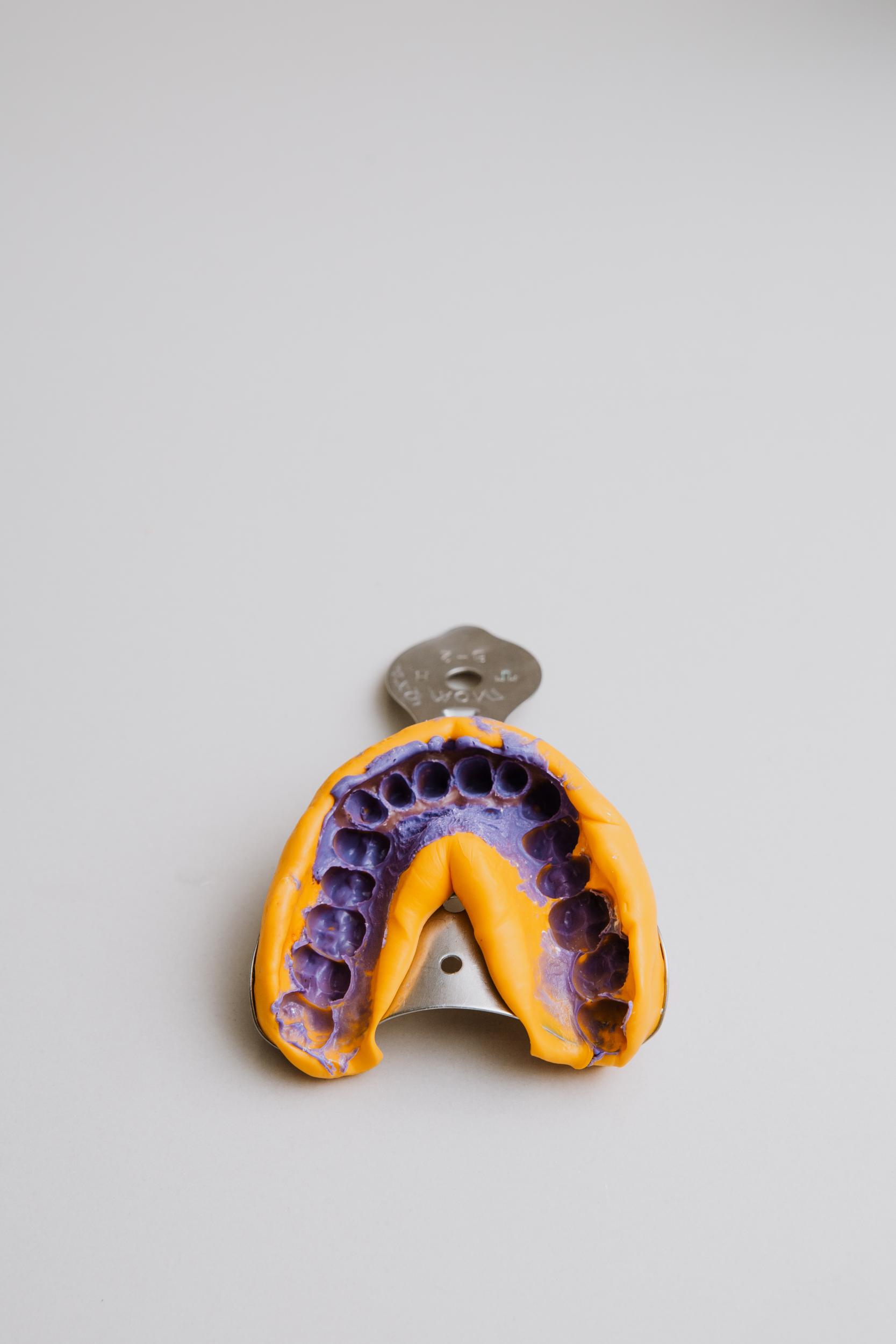 Get Partial Dentures In Carmel, IN: Replace Missing Teeth At Top Dental Practice